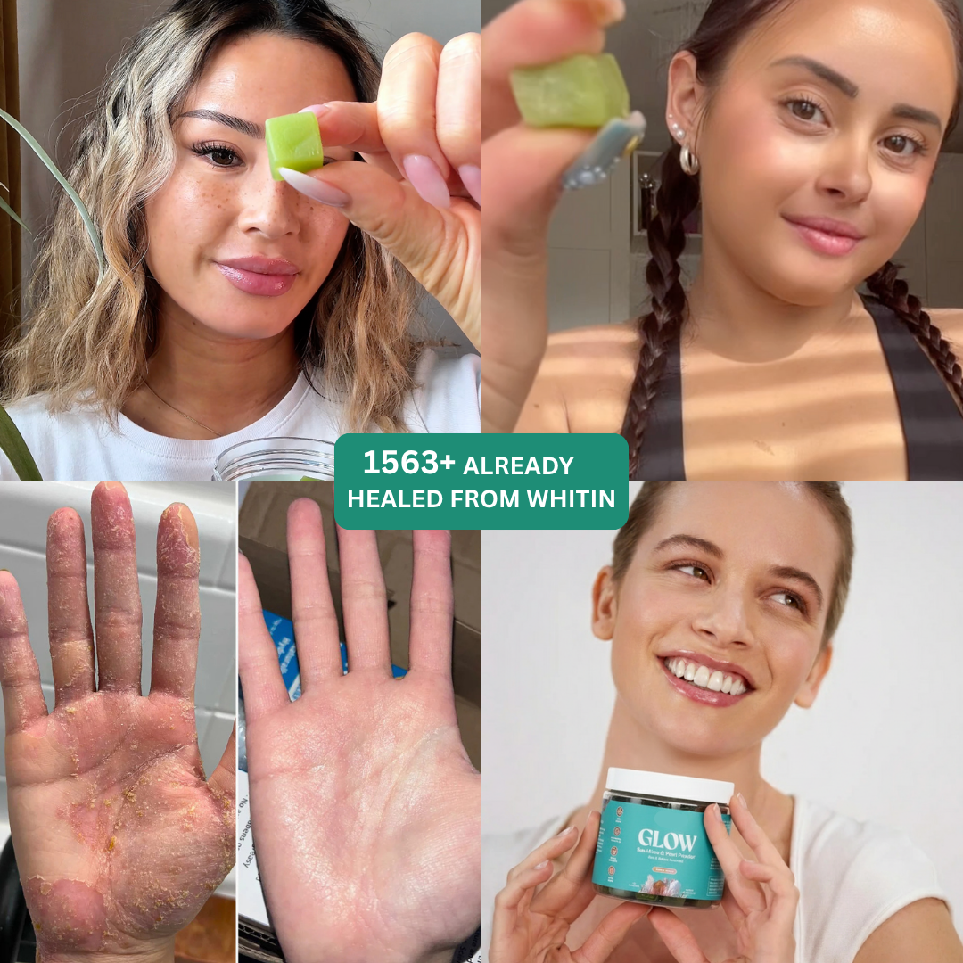 Eczema Relief Gummies